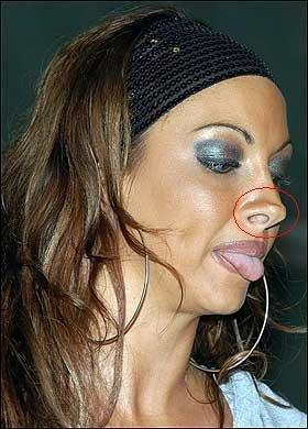 整形死亡明星,揭秘那些因整形手术而陨落的明星